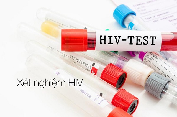 top 5 dia chi xet nghiem hiv uy tin