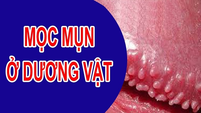 mun moc o duong vat canh bao benh gi